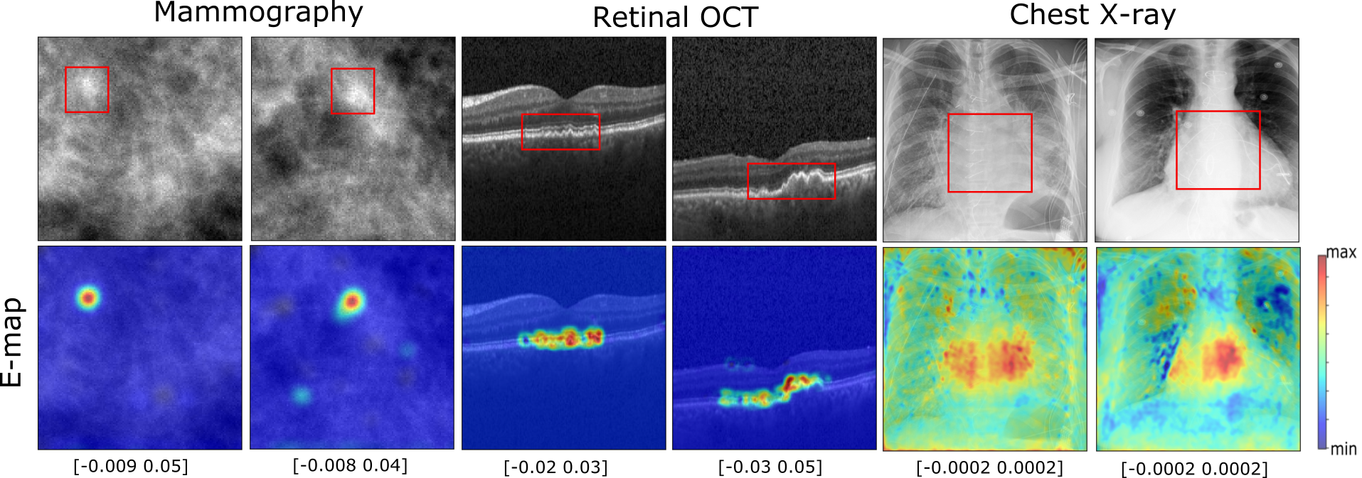 Self-interpretable CNN via test statistic estimation