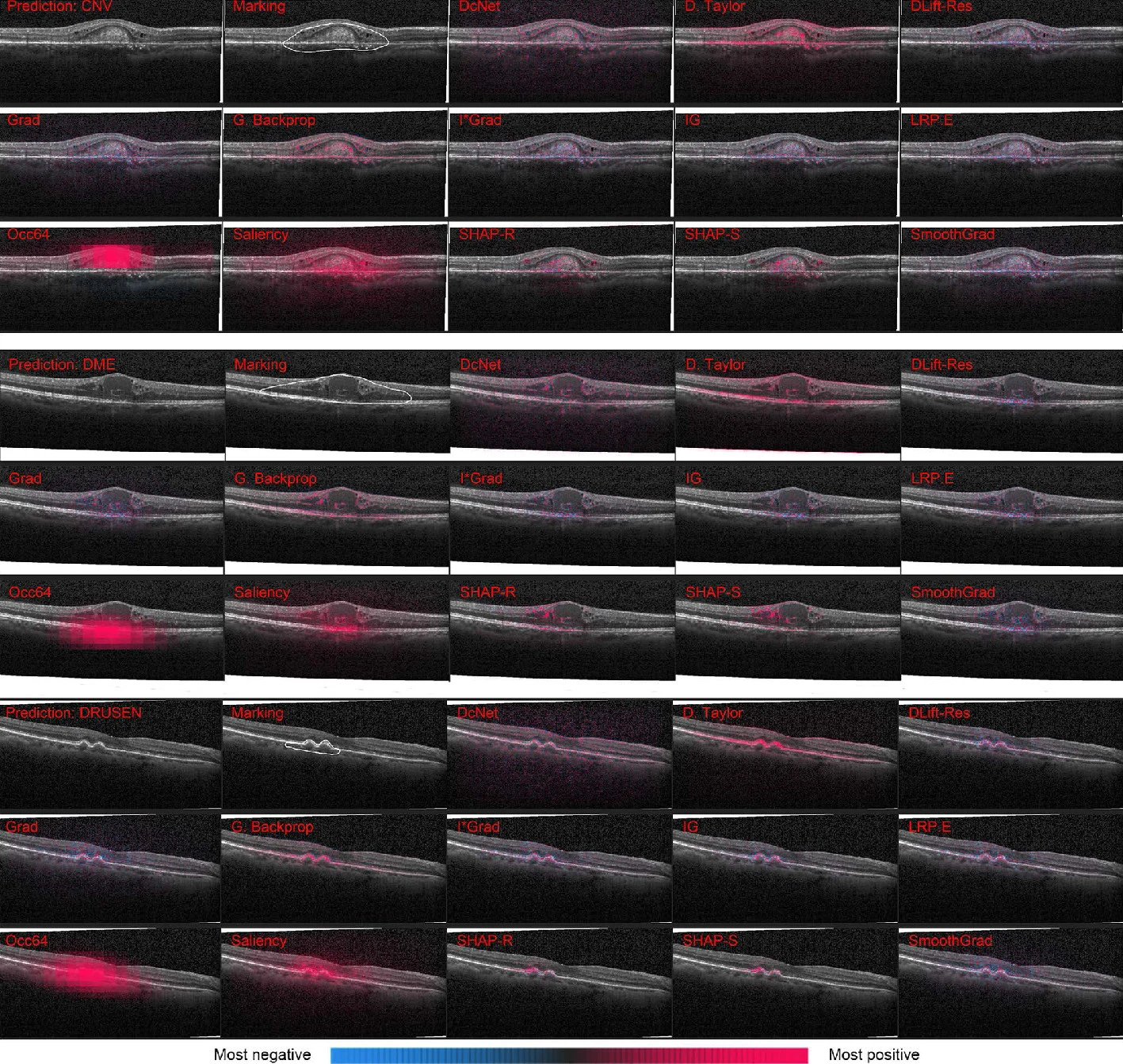 Optimal attribution for ophthalmic disease classification