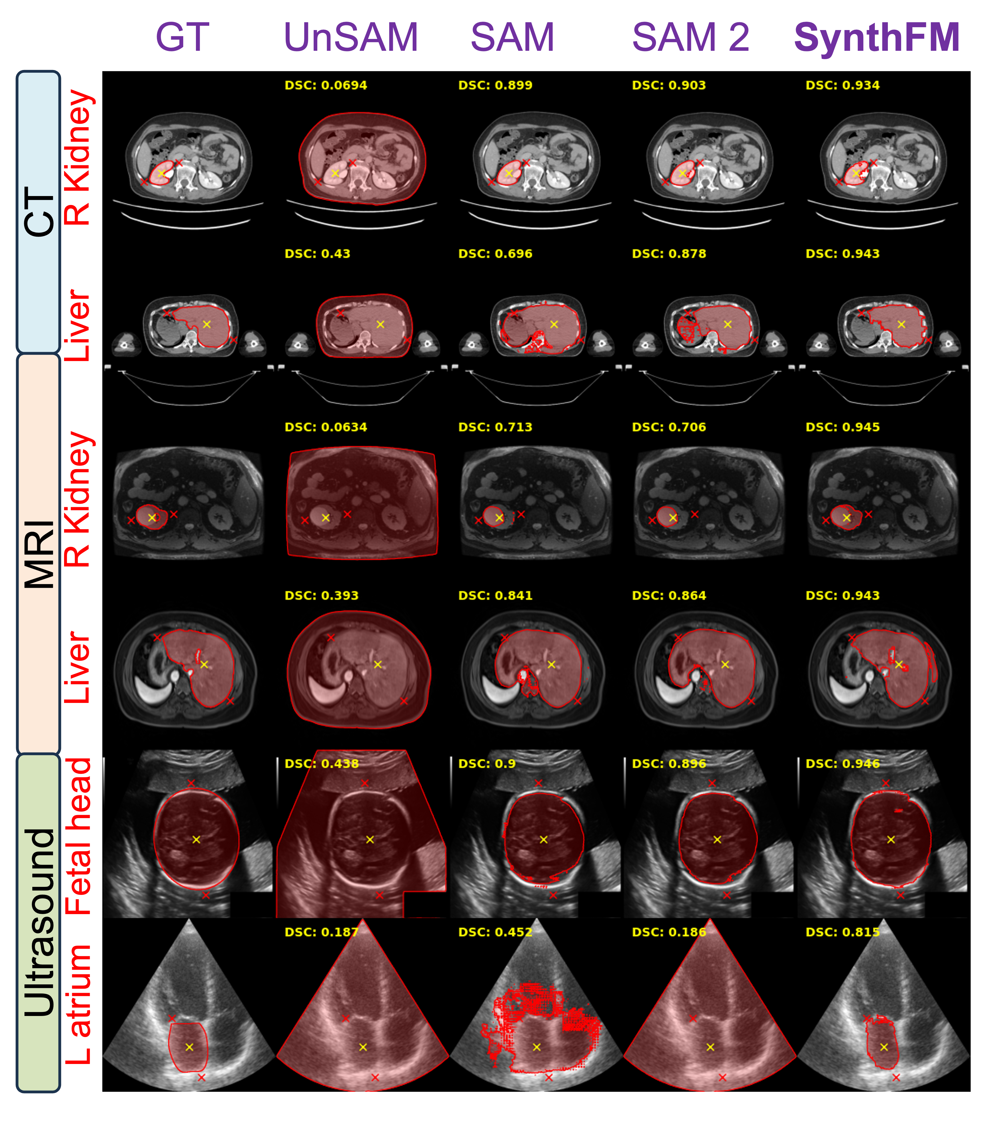 SynthFM framework teaser